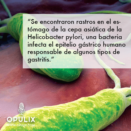 oetzi1